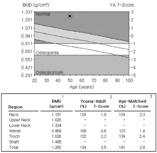 Fig. 8. Dual Energy X-ray Absorptiometry of the patient shows T score 2.5 of bone densitometry.