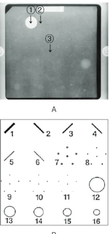 Fig.  3.  A  image  is  showed  Film  image  of  breast  phantom  and  B  image  is  showed  shape  and 