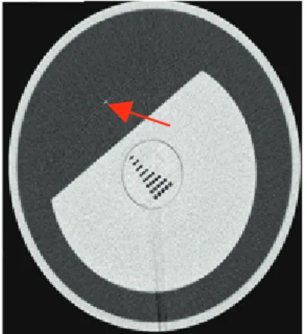 Fig.  2.  CT  number  and  Noise