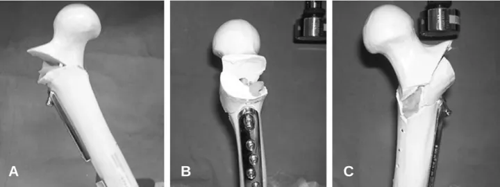 Fig. 7. Biomechanical study of group 2(TSP group). (A) Anterior aspect of the bone-plate complex after Instron loading