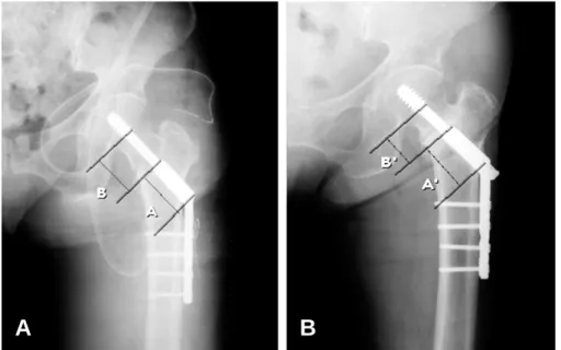Fig. 1. The Method of measuring of Lag screw sliding.