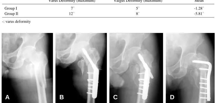 Fig. 3. (A) 66 year-old man. The X-ray showing preop intertrochanteric Fx. (B) Immediate postop