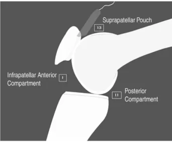 Table 1. Location of Loose Bodies