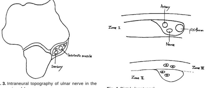 Fig. 3. Intraneural topography of ulnar nerve in the