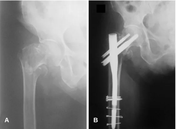 Table 4. Postoperative complications