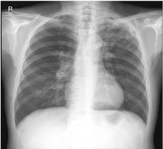 Fig. 4. Chest X-ray. Nonspecific finding, No abnormality is seen.