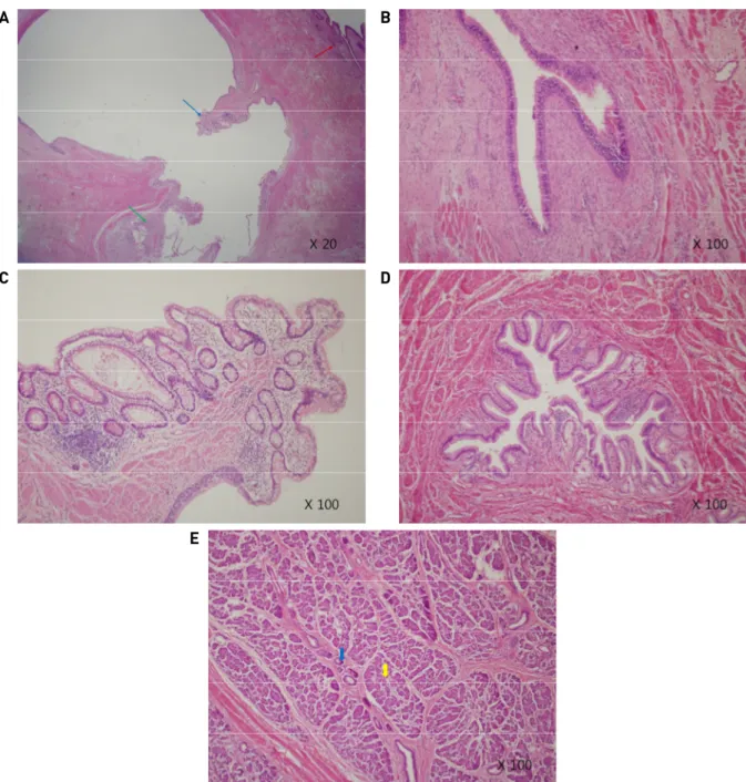 Fig. 7A. Red arrow  – bronchial mucosa, Blue arrow – colonic mucosa, Green arrow – gastric mucosa