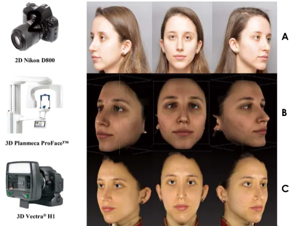 Fig. 2.  Image acquisition. A. Two-dimensional camera. B. Three-dimensional laser scanner