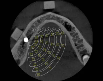 Fig. 3.  The magnitude of artifacts is evaluated by grouping the re- re-gions of interest located in the same circle