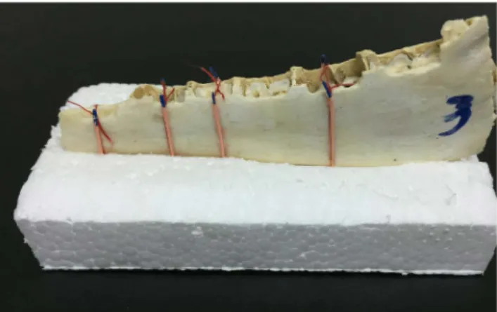 Fig. 1.  A hemi-mandible fixed in the central slit of a plastic foam  block. The 4 regions are defined by gutta-percha markers on the  buccal and lingual sides.