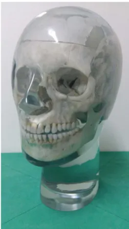 Fig. 3.  A real skull phantom with a soft-tissue replica.