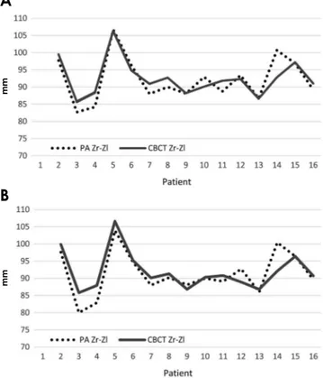 Fig. 5.  Raw data of right-side and left-side cone-beam comput- comput-ed tomography (CBCT) measurements compared with half of  the inter-zygomatic distance measured on PA cephalograms