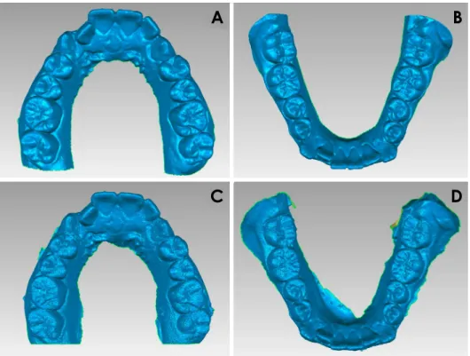 Fig. 2.  Three­dimensional digital  models of the plaster casts were ob­