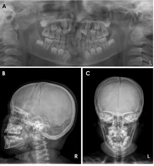 Fig. 2.  Case 1. A. Panoramic ra­