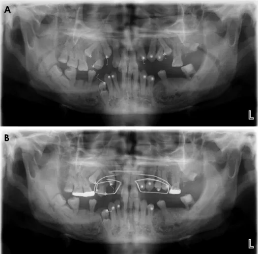 Fig. 7.  Case 2. Panoramic radio­