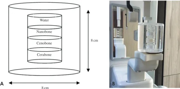 Table 1.  Gray values of each material and comparative tests for the 2 cone-beam computed tomography (CBCT) systems with 2 field-of- field-of-view (FOV) sizes and the Hounsfield unit (HU) values of each material in multidetector computed tomography (MDCT).