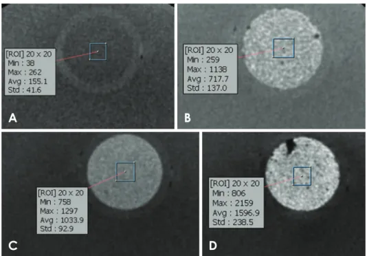 Fig. 2.  Samples of cone-beam  computed tomographic images and  selection of the region of interest  for calculating the mean gray value (MGV), using the Cranex 3D  sys-tem with a large field of view (axial  cuts)
