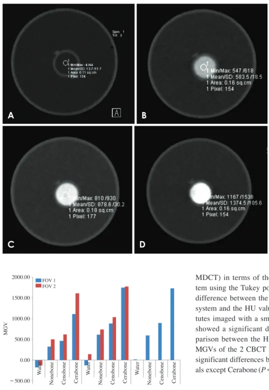 Fig. 3.  Multidetector computed  tomography images. A. Water. B. 