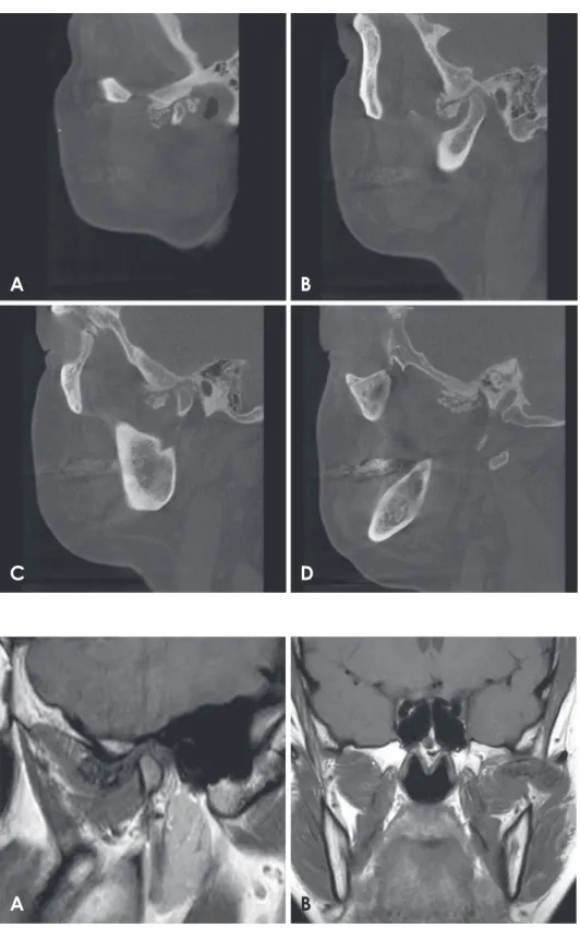 Fig. 4.  Sagittal cone-beam comput- comput-ed tomographic (CBCT) images. A. 