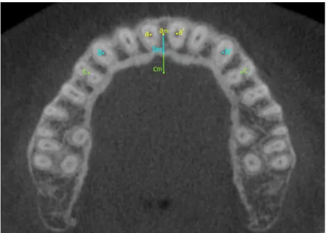 Fig. 1.  Example of a maxillary alveolar arch, where a and aʹ are the root center points of central incisors