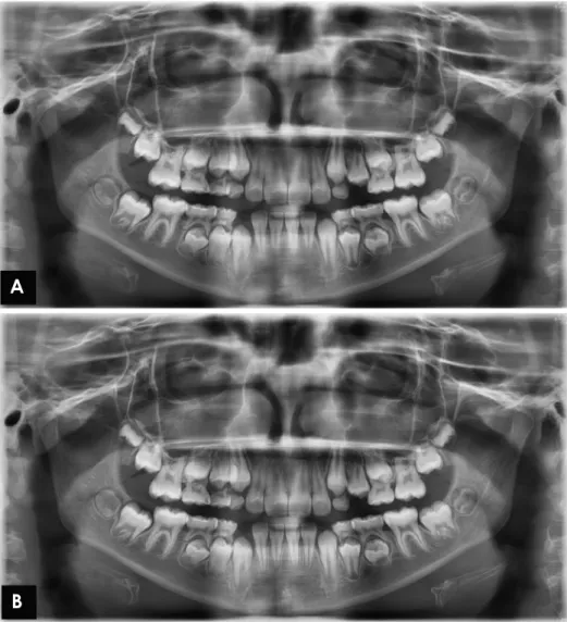 Fig. 1.  Digital panoramic image. A. 