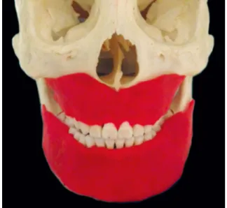 Fig. 1.  Play-Doh on the maxilla and mandible simulating soft tis- tis-sue density.