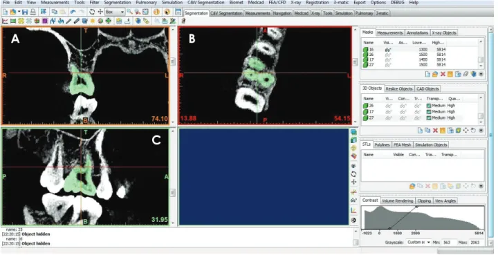 Fig. 1.  Identification of tooth morphology on 2-dimensional images of each slice orientation