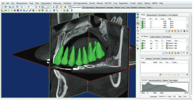 Fig. 4.  Identification of the cementoenamel junction and automatic calculation of the root surface area using 3-Matic Research version 9.0.