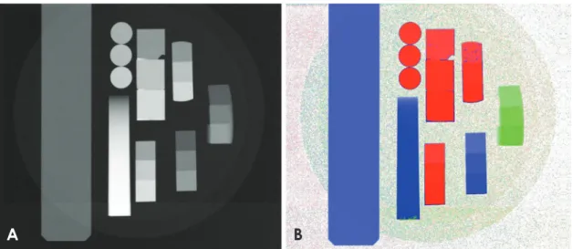 Fig. 1.  Comparison of classical grayscale and new colored radiographs. The proposed method assigned distinct colors to different materials  based on their atomic number