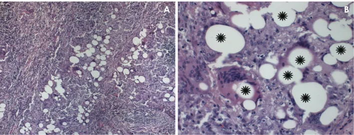 Fig. 3.  Histopathological view (hematoxylin and eosin stain; original magnification A