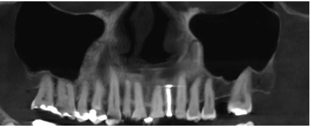 Fig. 1.  Cone beam CT panoramic re­
