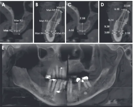 Fig. 1.  Maxillary and mandibular measurement sites on the cone-beam computed tomography images