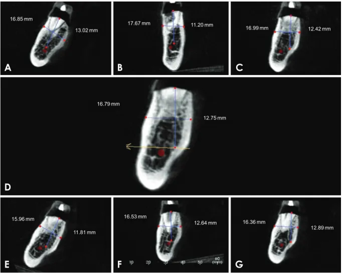 Figure 3 shows the interactions between the mean er­