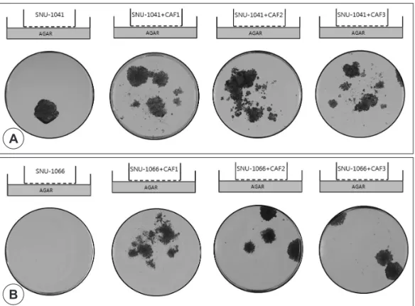 Fig. 4. CAFs stimulated cancer cell migration and colony formation. By adding soft agar to the bottom chambers of transwell dishes,  we checked both the migration ability and colony-forming ability of cancer cells