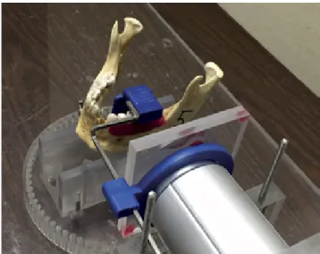 Fig. 1.  A photograph shows the use of soft tissue simulation in ac­