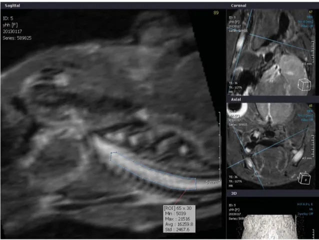 Fig. 3. The ROI of the incisor pulp tissue below the molar teeth on the modified sagittal section is obtained along the long axis of the incisor