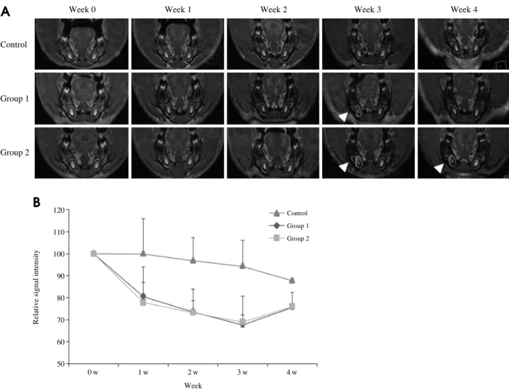 Fig. 5. A. The MR images show the changes during the 4 weeks after irradiation. The SI of the irradiated tissues around the right incisor pulp has increased (arrowhead)