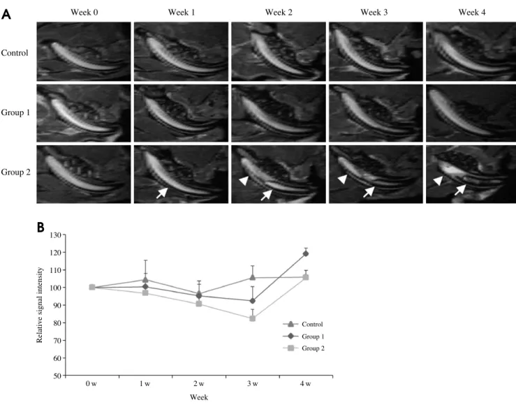 Fig. 6. A. The MR images show the changes during the 4 weeks after irradiation. A modified sagittal view is obtained along the long axis of the incisor
