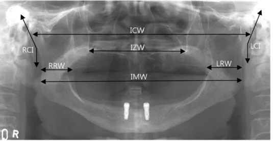 Fig. 2. Reference points, lines, and angles of measurement variables are seen on a panoramic radiograph.