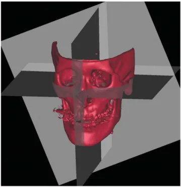 Fig. 1. Three orthogonal planes are established for each subject.