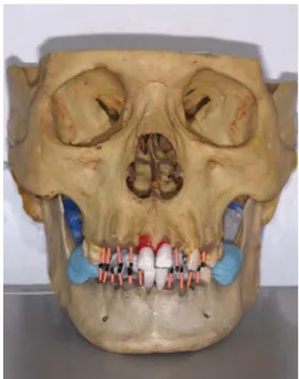 Fig. 1. An example of dry skull specimen with mandible fixed to the cranium.