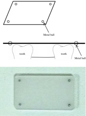 Fig. 1. Plastic plate for determination of a reference plane. For ra- ra-diographic recognition, 4 metal balls (2 mm in diameter) are  insert-ed in each of the 4 corners of the plate 2 mm away from the insert-edge of the plate.