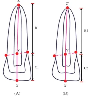 Table 1. The examination factors and their units of measurement for external apical root resorption per (Mann-Whitney U and  Kru-skal-Wallis H test)