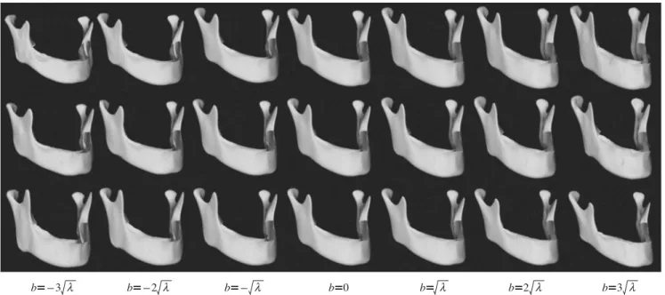Fig. 4. Characteristic models of variation produced by PCA for male mandibles. The mode corresponding to the largest variance (λ 1 ) is varied from to  to  (the first row), and the modes corresponding to the second mode (the second row) and the third mode 