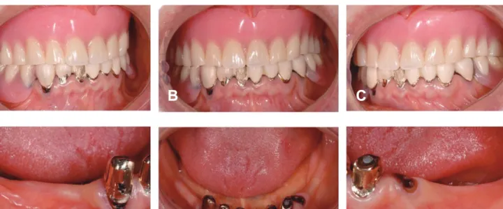 Fig. 1.  Clinical photos at the first visit. A. Lateral view of right side; B. Frontal view; C