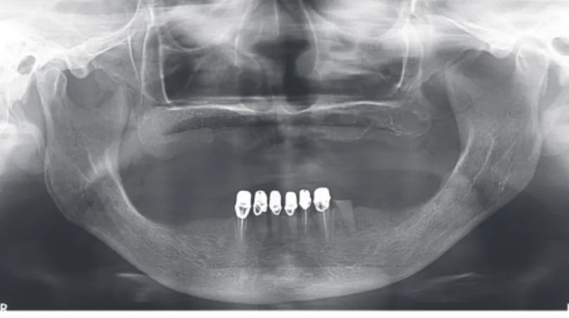 Fig. 2.  Panoramic radiographic at the first visit