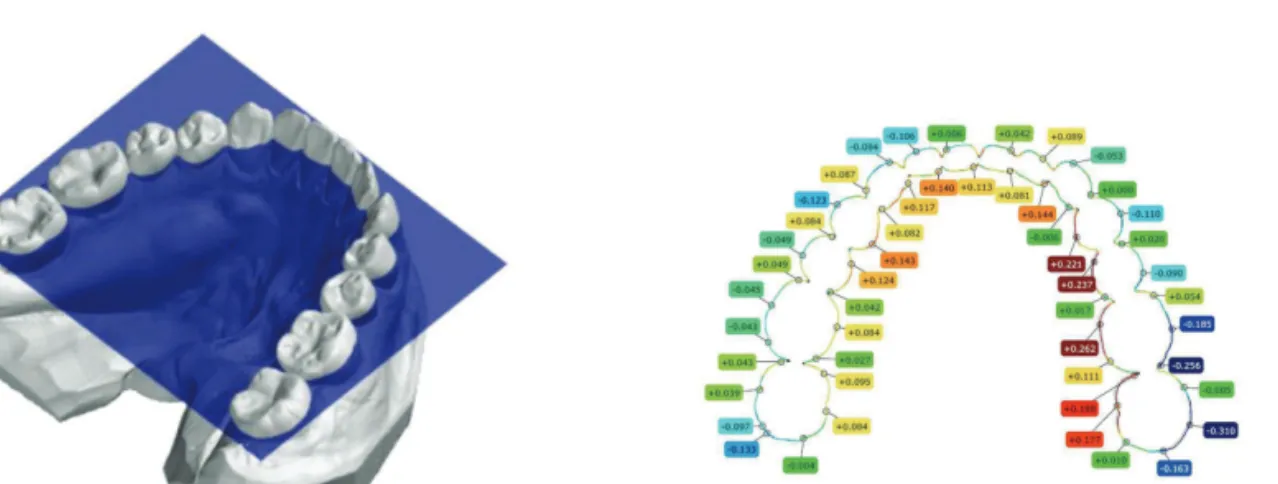 Fig. 1.  (A) 스톤모델을 환자의 구강위치와 동일하게 스폰지위에 위치시키고 CBCT를 촬영 (B) 동일 한 스톤모델을 모델스캐너로 스캔