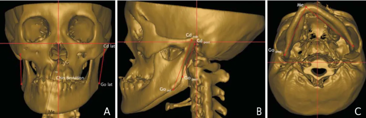 Table 1. Landmarks, planes and facial lines used for this study