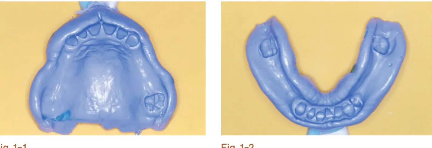 Fig 1-1. Fig 1-2.