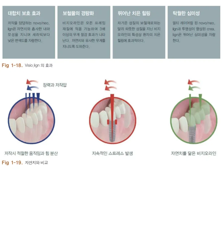 Fig 1-18.  Visio.lign 의 효과